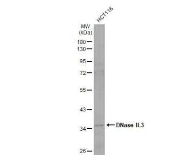 Western Blot: DNASE1L3 Antibody [NBP2-16198] - Whole cell extract (30 ug) was separated by 10% SDS-PAGE, and the membrane was blotted with DNase IL3 antibody [N3C3] diluted at 1:20000. The HRP-conjugated anti-rabbit IgG antibody (NBP2-19301) was used to detect the primary antibody.