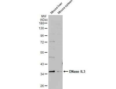 Western Blot: DNASE1L3 Antibody [NBP2-16198] - Various tissue extracts (50 ug) were separated by 10% SDS-PAGE, and the membrane was blotted with DNase IL3 antibody [N3C3] diluted at 1:1000. The HRP-conjugated anti-rabbit IgG antibody (NBP2-19301) was used to detect the primary antibody.