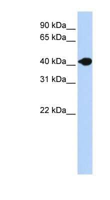 Western Blot: DNASE2B Antibody [NBP1-62278] - Human Muscle lysate, concentration 0.2-1 ug/ml.