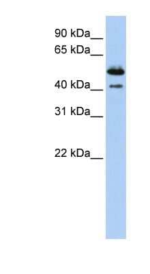 Western Blot: DNASE2B Antibody [NBP1-62279] - Human Placenta lysate, concentration 0.2-1 ug/ml.
