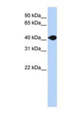Western Blot: DNASE2B Antibody [NBP1-69308] - This Anti-DNASE2B antibody was used in Western Blot of Fetal Muscle tissue lysate at a concentration of 1ug/ml.