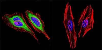 Immunocytochemistry/Immunofluorescence: DNCIC1 Antibody (74.1) [NB300-726] - Analysis of Dynein in HeLa Cells. Cells were grown on chamber slides and fixed with formaldehyde prior to staining. Cells were probed without (control) or with a Dynein monoclonal antibody at a dilution of 1:20 overnight at 4C, washed with PBS and incubated with a DyLight-488 conjugated secondary antibody. Dynein staining (green), F-Actin staining with Phalloidin (red) and nuclei with DAPI (blue) is shown.
