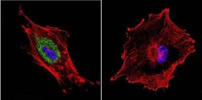 Immunocytochemistry/Immunofluorescence: DNCIC1 Antibody (74.1) [NB300-726] - Analysis of Dynein in U87-MG Cells. Cells were grown on chamber slides and fixed with formaldehyde prior to staining. Cells were probed without (control) or with a Dynein monoclonal antibody at a dilution of 1:20 overnight at 4C, washed with PBS and incubated with a DyLight-488 conjugated secondary antibody. Dynein staining (green), F-Actin staining with Phalloidin (red) and nuclei with DAPI (blue) is shown.