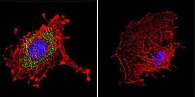 Immunocytochemistry/Immunofluorescence: DNCIC1 Antibody (74.1) [NB300-726] - Analysis of Dynein in C6 Cells. Cells were grown on chamber slides and fixed with formaldehyde prior to staining. Cells were probed without (control) or with a Dynein monoclonal antibody at a dilution of 1:20 overnight at 4C, washed with PBS and incubated with a DyLight-488 conjugated secondary antibody. Dynein staining (green), F-Actin staining with Phalloidin (red) and nuclei with DAPI (blue) is shown.
