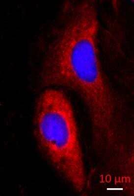 Immunocytochemistry/Immunofluorescence: DNCIC1 Antibody (74.1) [NB300-726] - analysis of DNCIC1 in caco-2 cells using anti-DNCIC1 antibody. Image from verified customer review.