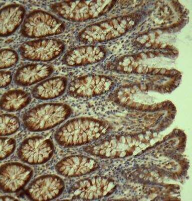 Immunohistochemistry-Paraffin: DNCIC1 Antibody (74.1) [NB300-726] - analysis of DNCIC1 in human colon tissue using anti-DNCIC1 antibody. Image from verified customer review.