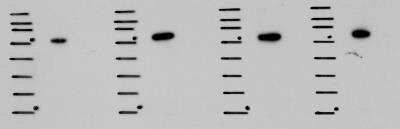Western Blot: DNCIC1 Antibody (74.1) [NB300-726] - analysis of DNCIC1 in human colon cancer cell lysates using anti-DNCIC1 antibody. Image from verified customer review.