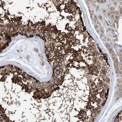 Immunohistochemistry-Paraffin: DNCIC1 Antibody [NBP1-87972] - Staining of human testis shows strong cytoplasmic positivity in cells in seminiferus ducts.