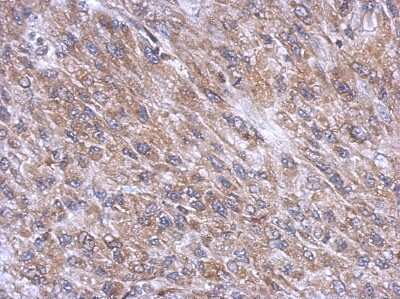 Immunohistochemistry-Paraffin: DNCIC1 Antibody [NBP2-16201] - Immunohistochemical analysis of paraffin-embedded U87 xenograft, using antibody at 1:500 dilution.