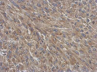Immunohistochemistry-Paraffin: DNCIC1 Antibody [NBP2-16202] - Immunohistochemical analysis of paraffin-embedded U87 xenograft, using antibody at 1:500 dilution.