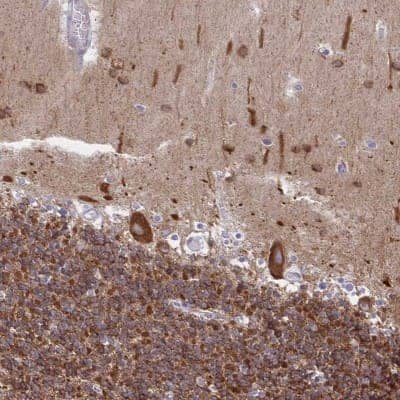 Immunohistochemistry-Paraffin: DNCIC1 Antibody [NBP2-38933] - Staining of human cerebellum shows strong cytoplasmic positivity in Purkinje cells, cells in molecular layer and cells in granular layer.
