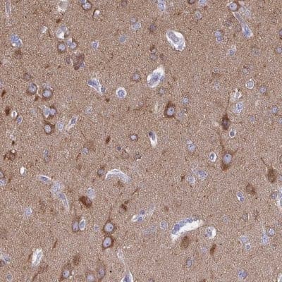 Immunohistochemistry-Paraffin: DNCIC1 Antibody [NBP2-38933] - Staining of human cerebral cortex shows high expression.