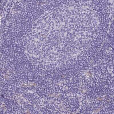 Immunohistochemistry-Paraffin DNCIC1 Antibody - BSA Free