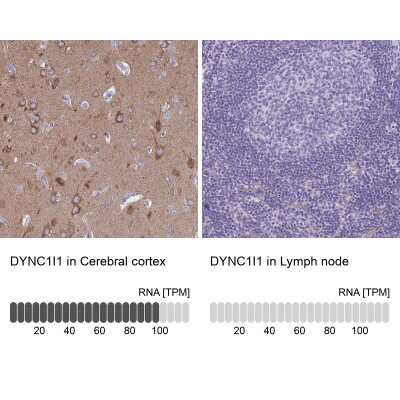 <b>Orthogonal Strategies Validation. </b>Immunohistochemistry-Paraffin: DNCIC1 Antibody [NBP2-38933] - Staining in human cerebral cortex and lymph node tissues using anti-DYNC1I1 antibody. Corresponding DYNC1I1 RNA-seq data are presented for the same tissues.