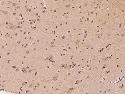 Immunohistochemistry-Paraffin: DNCIC1 Antibody [NBP2-97805] - Immunochemical staining of human DNCIC1 in human brain with rabbit polyclonal antibody at 1:100 dilution, formalin-fixed paraffin embedded sections.