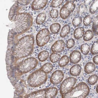 Immunohistochemistry-Paraffin: DNMBP Antibody [NBP1-88817] - Staining of human stomach shows moderate cytoplasmic positivity in glandular cells.