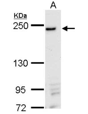 Western Blot: DNMBP Antibody [NBP2-16203] - A. 30 ug MDA-MB-231 whole cell lysate/extract 5 % SDS-PAGE DNMBP antibody dilution: 1:250