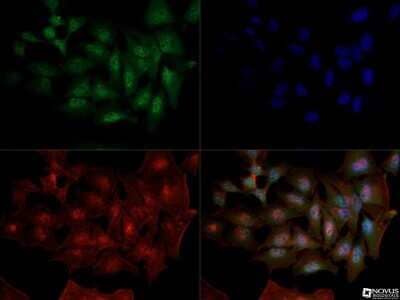 Immunocytochemistry/Immunofluorescence: DNMT1 Antibody (60B1220.1) - Azide and BSA Free [NBP2-80697] - Dnmt1 antibody was tested in HeLa cells with Dylight 488 (green). Nuclei and alpha-tubulin were counterstained with DAPI (blue) and DyLight 550 (red). Antibody dilution of 1:10 was used. Image objective 40x. Image from the standard format of this antibody.