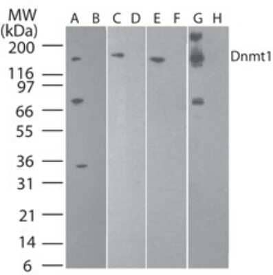 Western Blot: DNMT1 Antibody (60B1220.1) - Azide and BSA Free [NBP2-80697] - Analysis of Dnmt1 in 2102EP (human embryonic carcinoma) in the A) absence and B) presence of immunizing peptide, recombinant human Dnmt1 protein in the C) absence and D) presence of immunizing peptide, NIH 3T3 (mouse embryonic fribroblast) in the E) absence and F) presence of immunizing peptide, and D3 (mouse embryonic stem cell) in the G) absence and H) presence of immunizing peptide using Dnmt1 antibody. this antibody. 5 ug/ml for testing the human cell line and 0.1 ug/ml was used for testing the recombinant protein and the mouse cell lines. &rsquo;s goat anti-mouse Ig HRP secondary antibody and PicoTect ECL substrate solution were used for this test. Image from the standard format of this antibody.