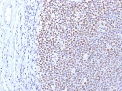 Immunohistochemistry-Paraffin: DNMT1 Antibody (DNMT1/2061) - Azide and BSA Free [NBP3-08482] - Formalin-fixed, paraffin-embedded human Tonsil stained with DNMT1 Mouse Monoclonal Antibody (DNMT1/2061).