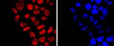 Immunocytochemistry/Immunofluorescence: DNMT1 Antibody (JF09-89) [NBP2-66805] - Staining Dnmt1 in Hela cells (red). The nuclear counter stain is DAPI (blue). Cells were fixed in paraformaldehyde, permeabilised with 0.25% Triton X100/PBS.
