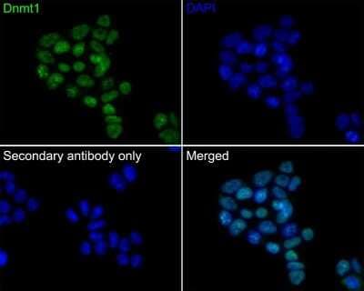 Immunocytochemistry/Immunofluorescence: DNMT1 Antibody (JF09-89) [NBP2-66805] - Analysis of F9 cells labeling DNMT1 with Rabbit anti-Dnmt1 antibody (permeabilized with 0.05% Triton X-100 in PBS for 20 minutes, and then blocked with 2% negative goat serum for 30 minutes at room temperature. Cells were then incubated with Rabbit anti-Dnmt1 antibody  was used as the secondary antibody at 1/1,000 dilution. PBS instead of the primary antibody was used as the secondary antibody only control. Nuclear DNA was labelled in blue with DAPI.