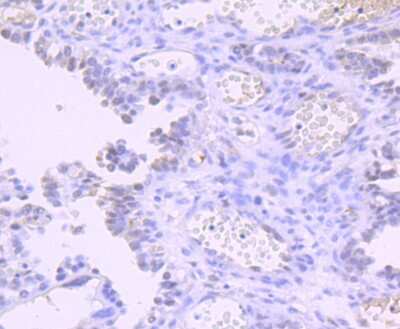 Immunohistochemistry-Paraffin: DNMT1 Antibody (JF09-89) [NBP2-66805] - Analysis of paraffin-embedded mouse placenta tissue using anti-Dnmt1 antibody. Counter stained with hematoxylin.