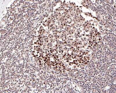 Immunohistochemistry-Paraffin: DNMT1 Antibody (JF09-89) [NBP2-66805] - Analysis of paraffin-embedded human lymph nodes tissue with Rabbit anti-DNMT1 antibody washed with ddH2O and PBS, and then probed with the primary antibody  at 1/200 dilution for 1 hour at room temperature. The detection was performed using an HRP conjugated compact polymer system. DAB was used as the chromogen. Tissues were counterstained with hematoxylin and mounted with DPX.