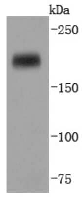 Western Blot: DNMT1 Antibody (JF09-89) [NBP2-66805] - Analysis of Dnmt1 on HepG2 cells lysates using anti-Dnmt1 antibody at 1/1,000 dilution.