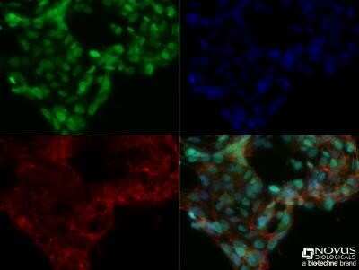 Immunocytochemistry/Immunofluorescence: DNMT3A Antibody (64B1446) - Azide and BSA Free [NBP2-80699] - Ntera2 cells were fixed for 10 minutes using 10% formalin and then permeabilized for 5 minutes using 1X TBS + 0.5% Triton-X100. The cells were incubated with anti-DNMT3A (68B1446) [NB120-13888] at a 1:200 dilution overnight at 4C and detected with an anti-mouse Dylight 488 (Green) at a 1:500 dilution. Actin was detected with Phalloidin 568 (Red) at a 1:200 dilution. Nuclei were counterstained with DAPI (Blue). Cells were imaged using a 40X objective. Image from the standard format of this antibody.