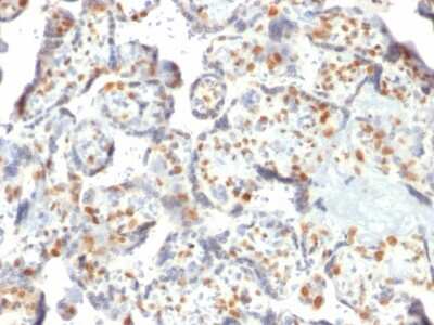 Immunohistochemistry-Paraffin: DNMT3A Antibody (PCRP-DNMT3A-1E2) [NBP3-08483] - Formalin-fixed, paraffin-embedded human Placenta stained with DNMT3A Mouse Monoclonal Antibody (PCRP-DNMT3A-1E2).