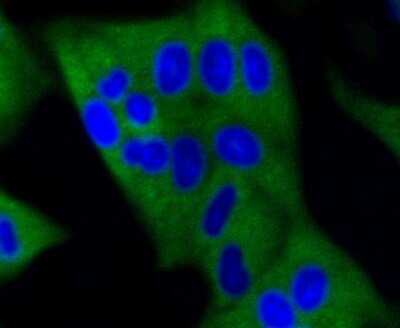 Immunocytochemistry/Immunofluorescence: DNMT3A Antibody (ST04-78) [NBP2-67505] - Staining Dnmt3a in Hela cells (green). The nuclear counter stain is DAPI (blue). Cells were fixed in paraformaldehyde, permeabilised with 0.25% Triton X100/PBS.