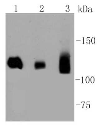 Western Blot: DNMT3A Antibody (ST04-78) [NBP2-67505] - Analysis of Dnmt3a on different lysates using anti-Dnmt3a antibody at 1/1,000 dilution. Positive control: Lane 1: Hela Lane 2: Human brain Lane 3: Human heart