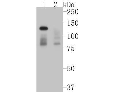 Western Blot: DNMT3A Antibody (ST04-78) [NBP2-67505] - Western blot analysis of DNMT3A on different lysates. Proteins were transferred to a PVDF membrane and blocked with 5% BSA in PBS for 1 hour at room temperature. The primary antibody (1/500) was used in 5% BSA at room temperature for 2 hours. Goat Anti-Ra
