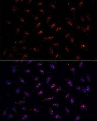 Immunocytochemistry/Immunofluorescence: DNTTIP2 Antibody [NBP2-92296] - Analysis of U-2 OS cells using DNTTIP2 at dilution of 1:100. Blue: DAPI for nuclear staining.