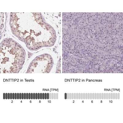 <b>Orthogonal Strategies Validation. </b>Immunohistochemistry-Paraffin: DNTTIP2 Antibody [NBP2-38710] - Staining in human testis and pancreas tissues using anti-DNTTIP2 antibody. Corresponding DNTTIP2 RNA-seq data are presented for the same tissues.