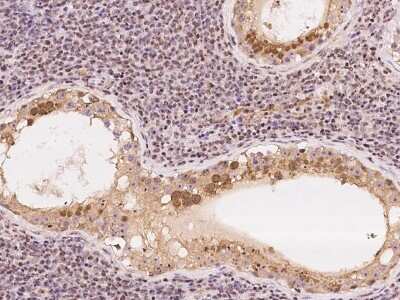 Immunohistochemistry-Paraffin: DNTTIP2 Antibody [NBP2-97758] - Immunochemical staining of human DNTTIP2 in human testis with rabbit polyclonal antibody at 1:100 dilution, formalin-fixed paraffin embedded sections.