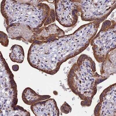 Immunohistochemistry-Paraffin DOC2B Antibody