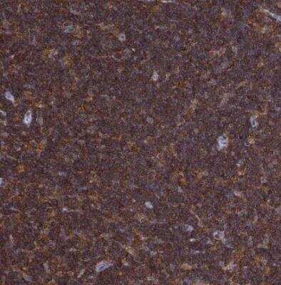 Immunohistochemistry-Paraffin DOCK10 Antibody - BSA Free