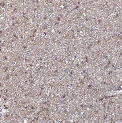 Immunohistochemistry-Paraffin: DOCK10 Antibody [NBP2-58637] - Staining of human cerrebral cortex shows moderate cytoplasmic positivity in glial cells.