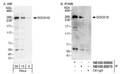 Western Blot: DOCK10 Antibody [NB100-60669] - Detection of Human DOCK10 on HeLa whole cell lystate using NB100-60670.