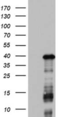 Western Blot: DOCK2 Antibody (7G2) [NBP2-46468] - Analysis of HEK293T cells were transfected with the pCMV6-ENTRY control (Left lane) or pCMV6-ENTRY DOCK2.