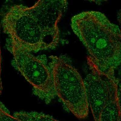 Immunocytochemistry/Immunofluorescence: DOCK4 Antibody [NBP2-57555] - Staining of human cell line PC-3 shows localization to nucleoli, plasma membrane & cytosol.