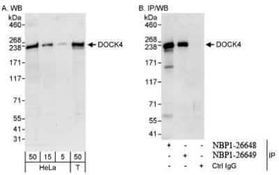 Western Blot DOCK4 Antibody