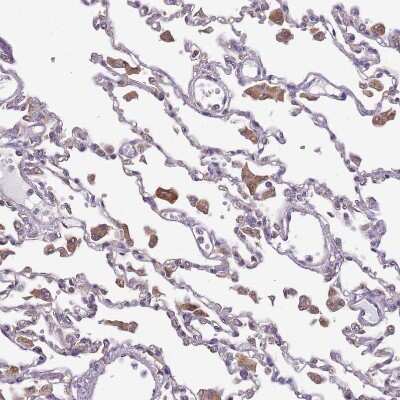 Immunohistochemistry-Paraffin: DOCK9 Antibody [NBP2-38517] - Staining of human lung shows moderate cytoplasmic positivity in macrophages.