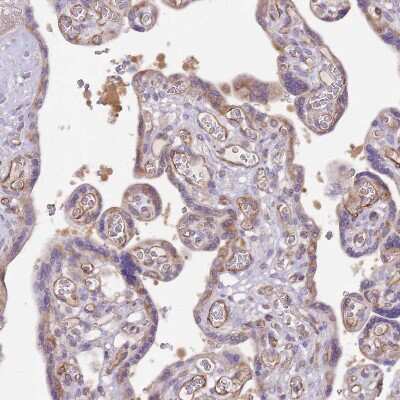 Immunohistochemistry-Paraffin: DOCK9 Antibody [NBP2-38517] - Staining of human placenta shows weak to moderate cytoplasmic positivity in trophoblastic cells.