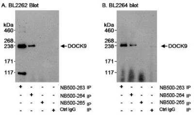 Immunoprecipitation: DOCK9 Antibody [NB500-264] - Detection of Human DOCK9 on HeLa whole cell lystate using NB500-263 and NB500-264, but not by NB500-265. IPed DOCK9 was blotted using  affinity purified rabbit anti-DOCK9 antibody NB500-263.