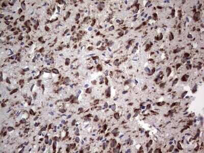 Immunohistochemistry: DOG1/TMEM16A Antibody (OTI1C8) - Azide and BSA Free [NBP2-71987] - Analysis of Human adult brain tissue. (Heat-induced epitope retrieval by 1 mM EDTA in 10mM Tris, pH8.5, 120C for 3min)