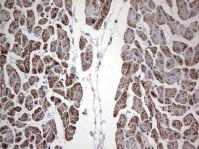 Immunohistochemistry: DOG1/TMEM16A Antibody (OTI1C8) - Azide and BSA Free [NBP2-71987] - Analysis of Human adult heart tissue. (Heat-induced epitope retrieval by 1 mM EDTA in 10mM Tris, pH8.5, 120C for 3min)