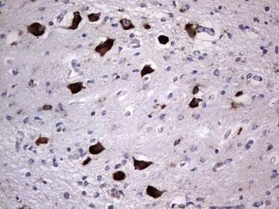 Immunohistochemistry: DOG1/TMEM16A Antibody (OTI1C8) - Azide and BSA Free [NBP2-71987] - Analysis of Human embryonic cerebellum tissue. . (Heat-induced epitope retrieval by 1 mM EDTA in 10mM Tris, pH8.5, 120C for 3min)